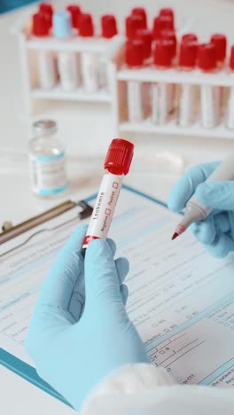 médico que prepara una muestra de sangre para su análisis durante un examen médico de rutina