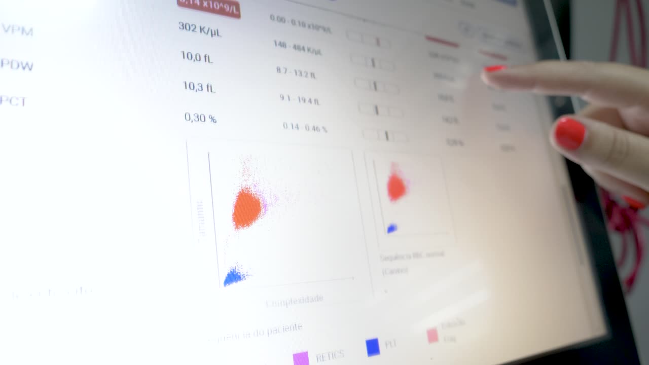 Kvinde ser på en skærm med en komplet blodtælling på en dyrlægeklinik