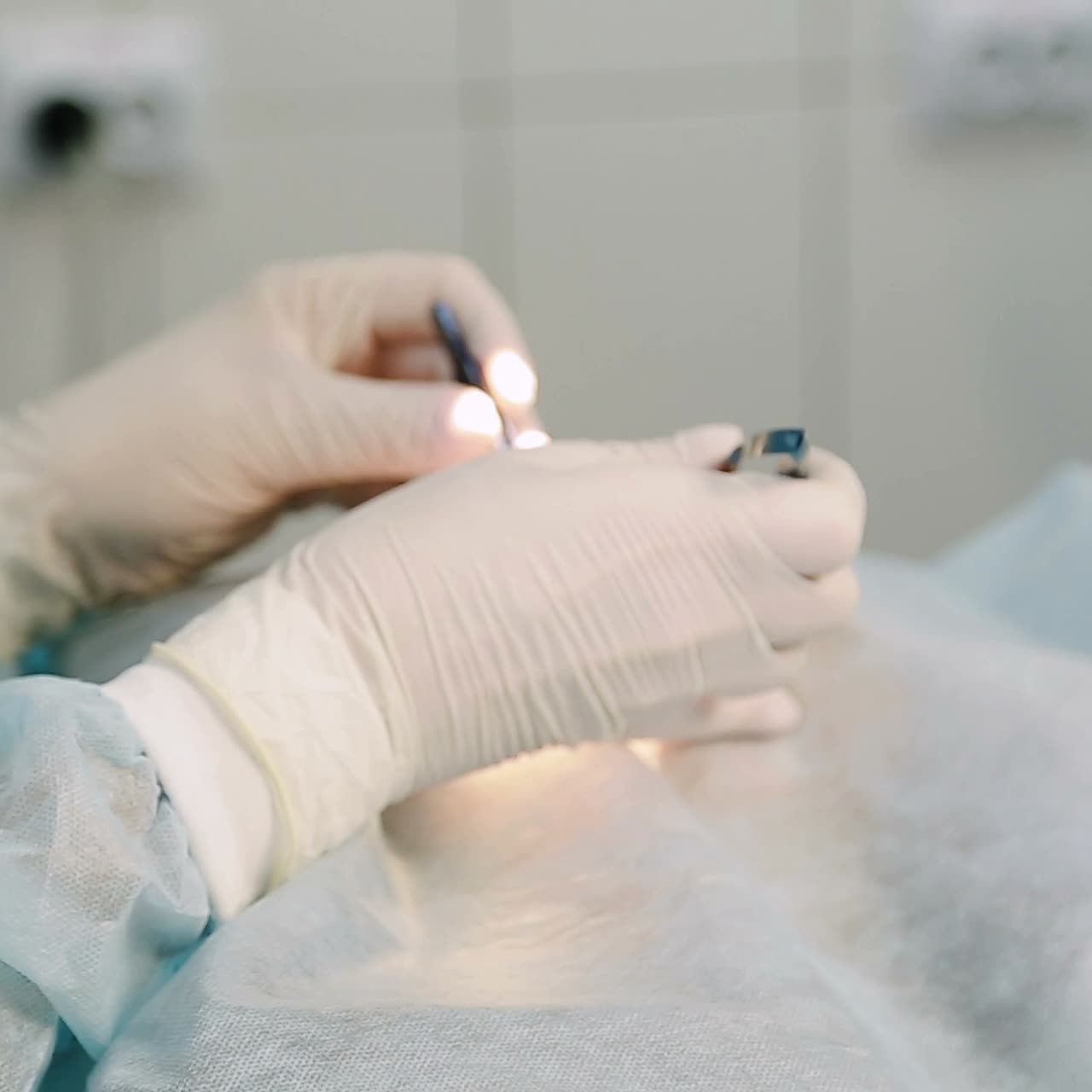 Chirurgia oculare in ospedale