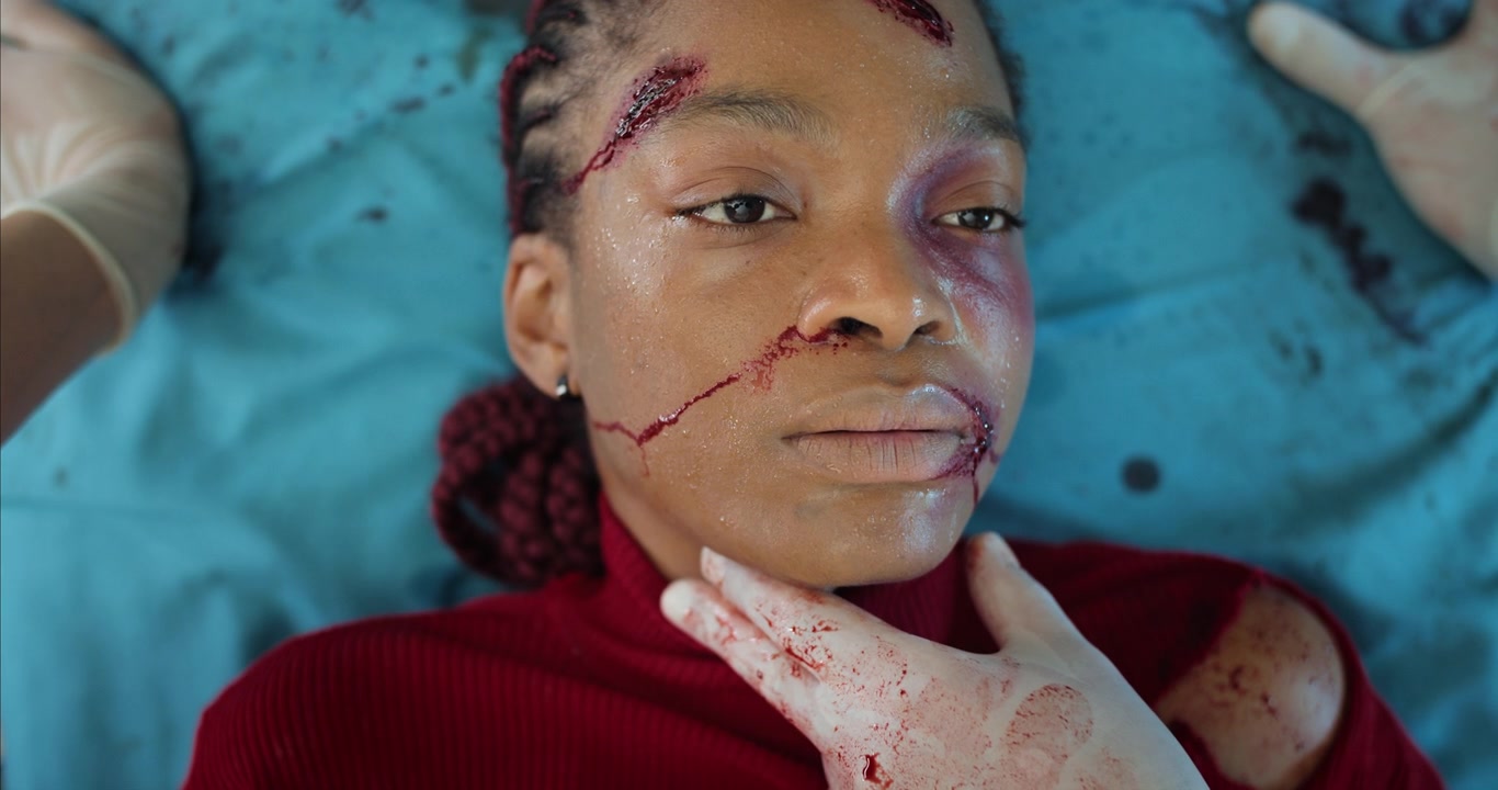 Close-up of Injured Woman with Oxygen Mask and Facial Wounds