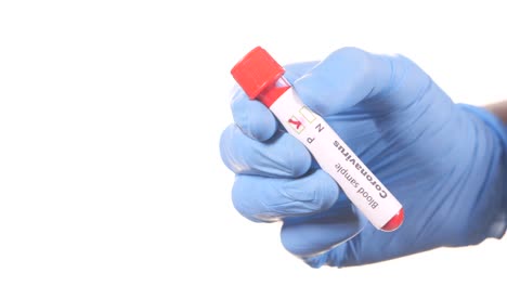 prueba de muestra de sangre de coronavirus
