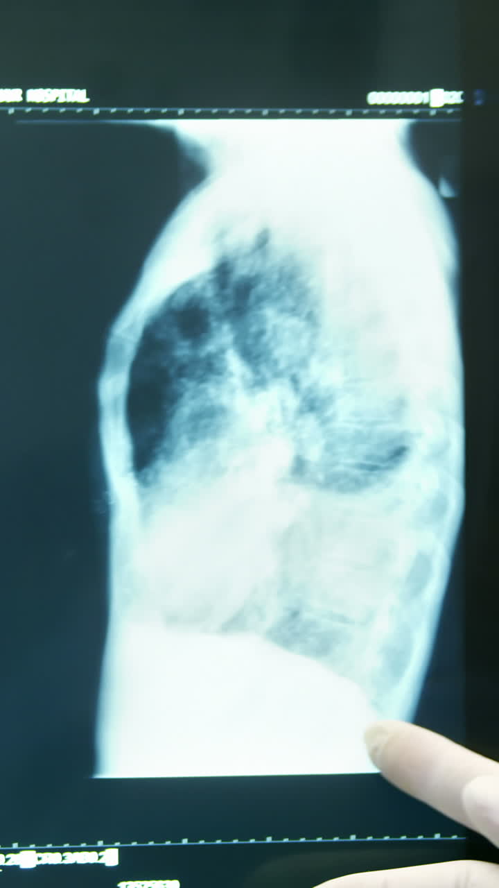 médico que examina las radiografías