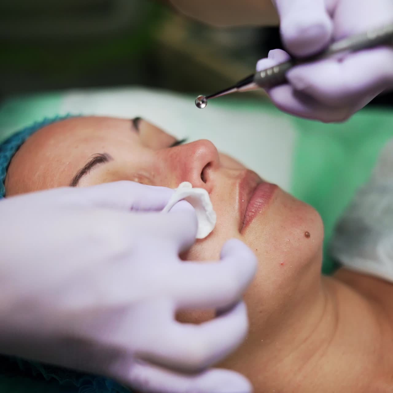 Estetista che pulisce i pori con l'aiuto di uno strumento speciale. Trattamenti estetici e cura della pelle in un salone di bellezza. Primo piano
