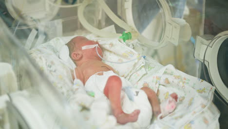 premature baby in neonatal intensive care unit