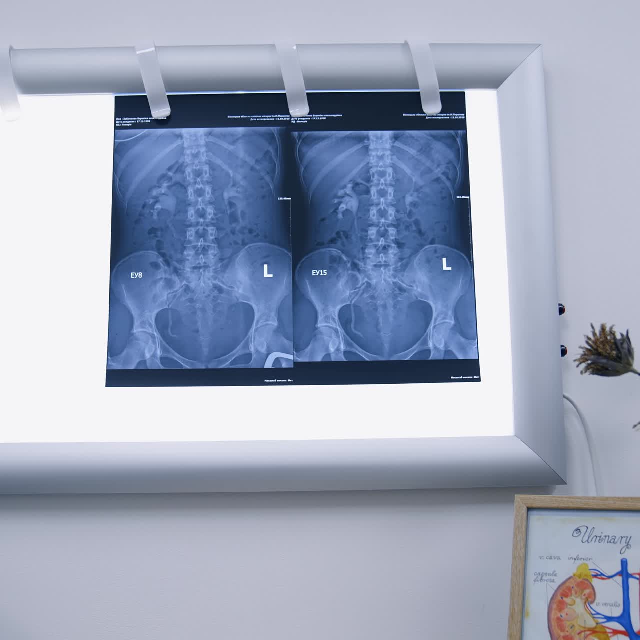 Healthcare specialist switches off the light screen and gives x-ray scan to a patient. Blonde long-haired woman takes the shot and thanks to a doctor