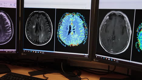 multiple mri brain scans