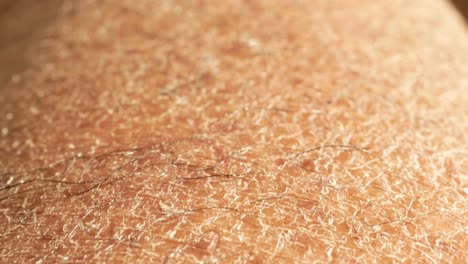 dry skin close up