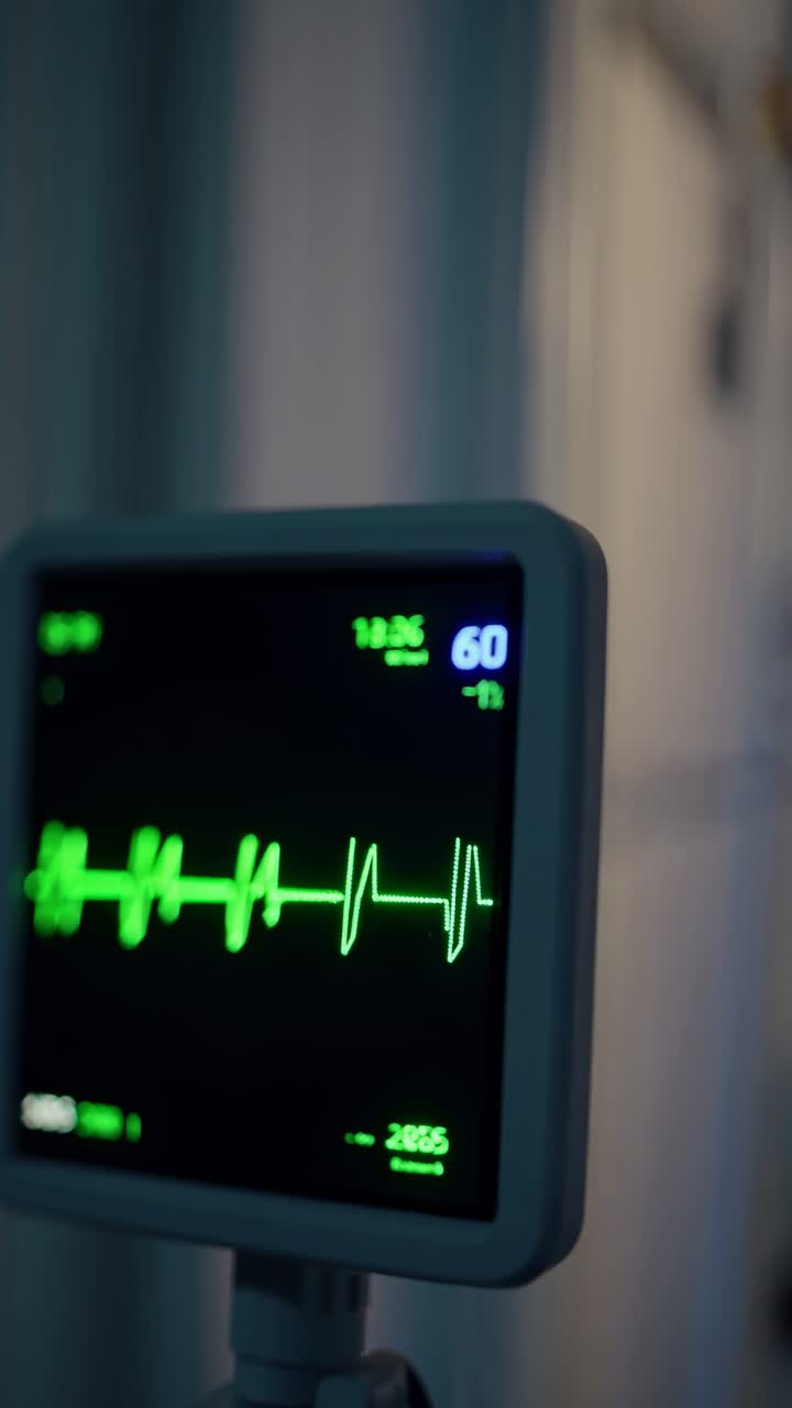 Inquadratura video ravvicinata di uno schermo di monitor cardiaco che mostra forme d'onda verdi, ripresa lateralmente