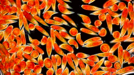 microscopic view of algae or protists