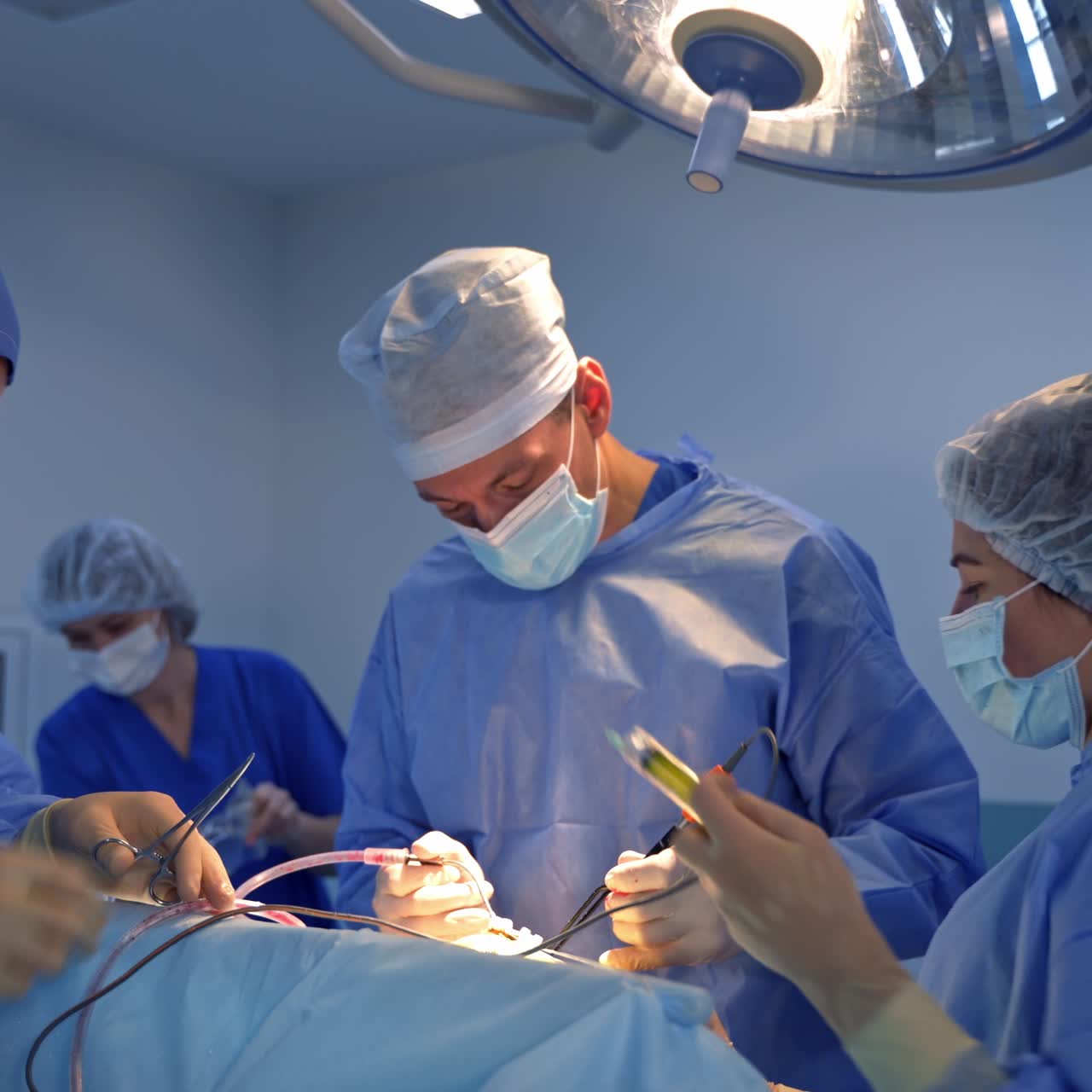 Neurosurgical operation conducted by professional medical team of doctors. Surgeon using tool devices, assistants help standing beside