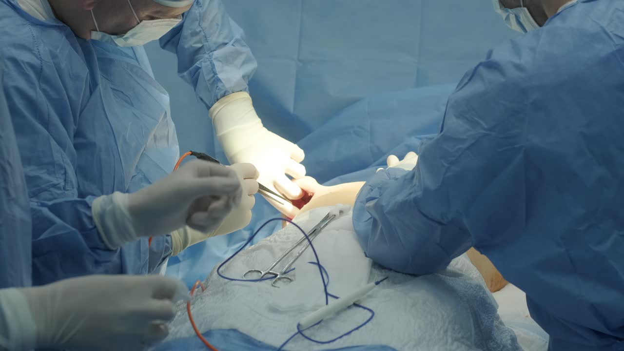 cirugía de extirpación de mamas bajo la guía del equipo de cirujanos, preparación para la colocación de implantes mamarios