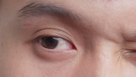 adult rubbing eyelid providing momentary relief from fatigue and irritation