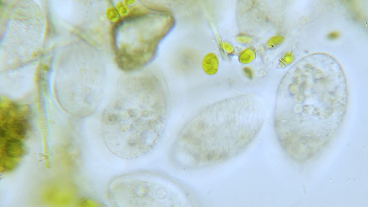paramecium popolazione ad alta densità in microscopio luminoso archiviato