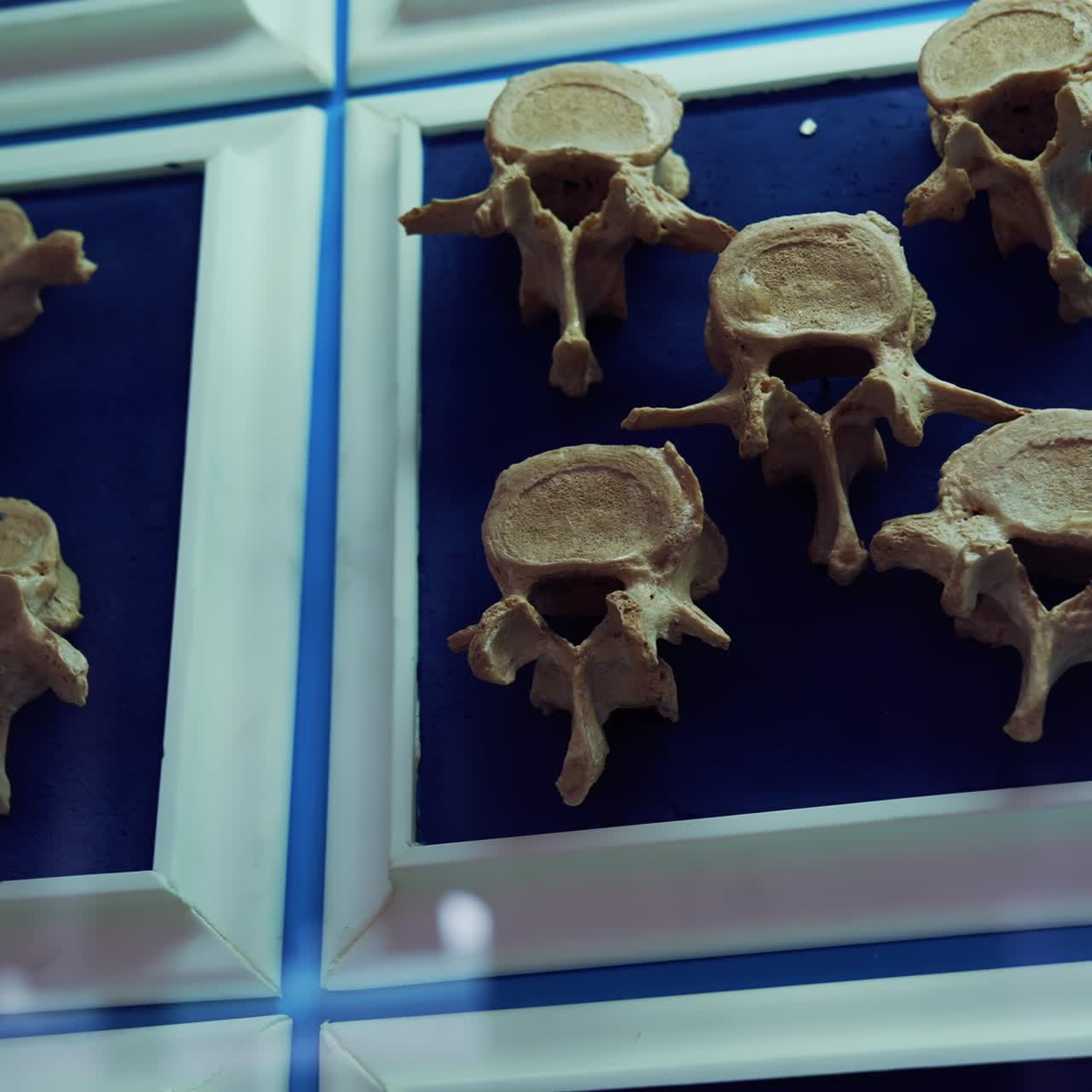 Parts of bones on the wall. Dummies of human bones. Artificial bones