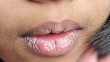 close-up of a person's lips with a possible dry or chapped condition