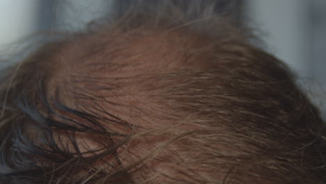 close up of a man's balding head