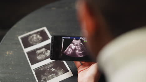 futuros padres felices disfrutan del registro de ultrasonido del bebé por teléfono