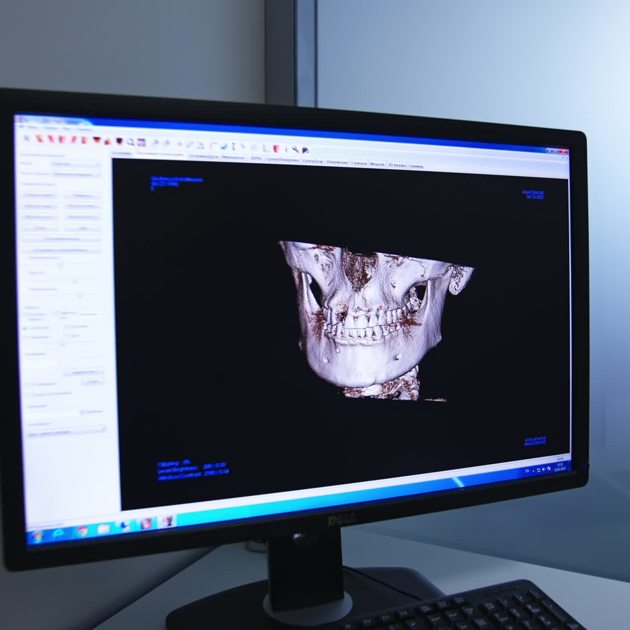 Medical monitor screen. Computer display healthcare treatment