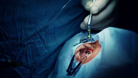 laser vision correction. ophthalmic clinic, surgery