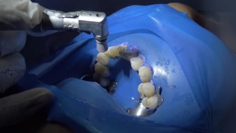 pulir los dientes con un pulidor