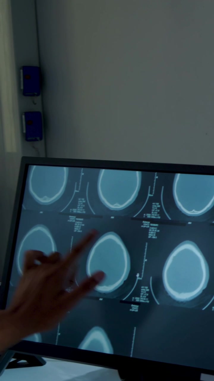 Video verticale: Donna appoggiata, in maglietta a maniche corte e con orologio, che tocca un monitor TC alla scrivania mentre valuta le scansioni.