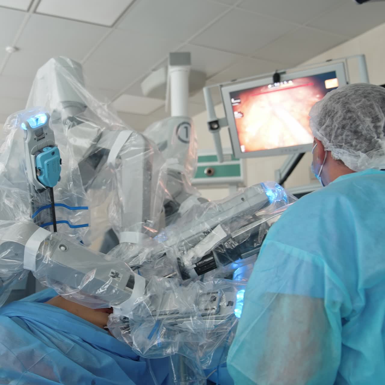 Medical robot during surgery. Futuristic surgical equipment in the operating room. Minimally invasive surgical system. Doctor controls the work of robotic device