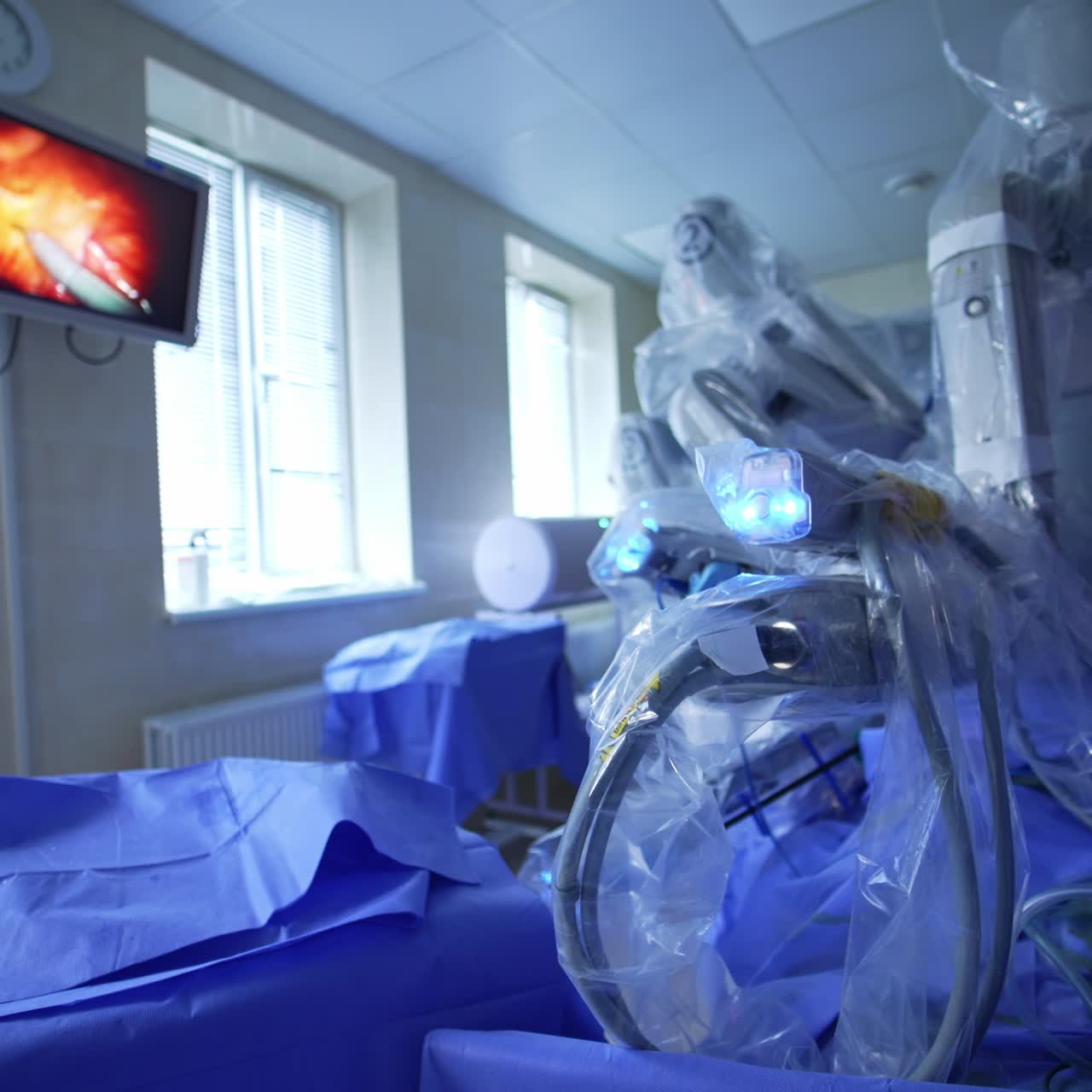 Advanced equipment working in the modern surgery room. Surgical procedure is shown at the screen hanging on the wall of the operational room