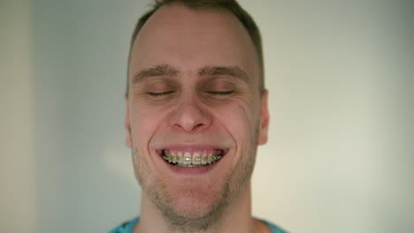 close up of young man smiling into the camera in slow motion with braces