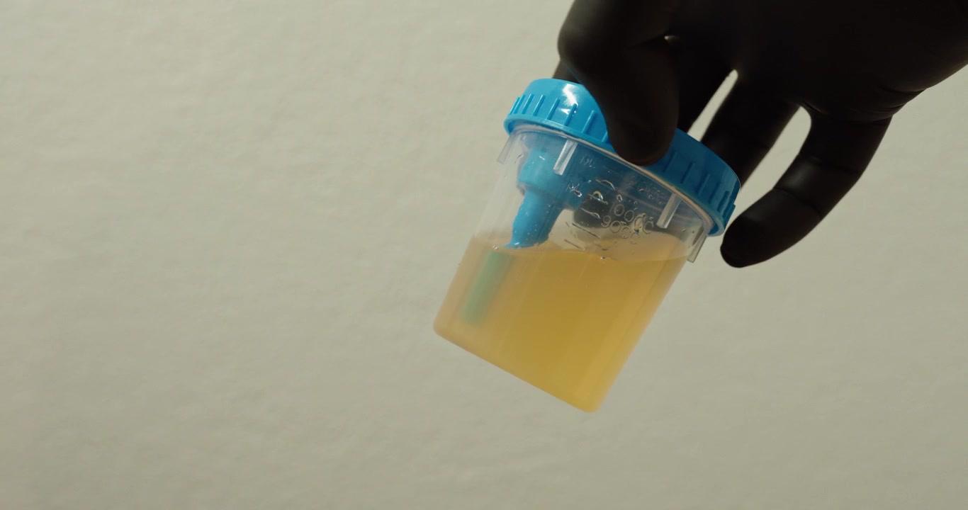 Close-up of a gloved hand holding a urine sample container, representing safe handling and hygiene in medical testing.