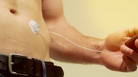 diabetic man with an insulin pump connected in his abdomen and holding the insulin pump at his hands. diabetes concept.