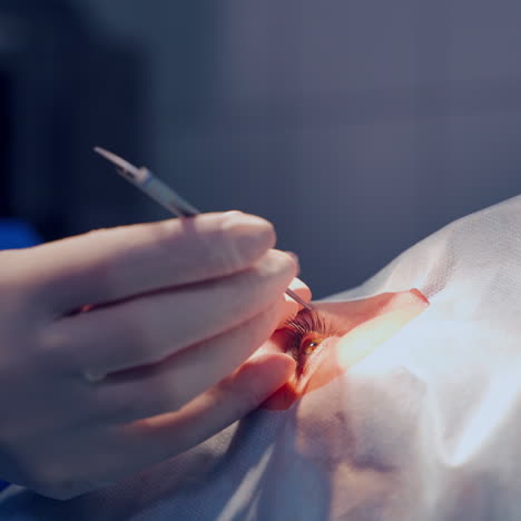 specialist performs an operation on an open eye. hands in gloves use medical instrument to treat ill eye. close-up.