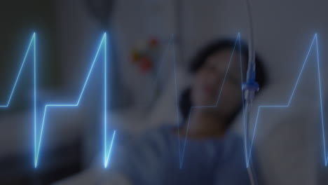 animation of heart rate monitor over african american female patient lying on the hospital bed