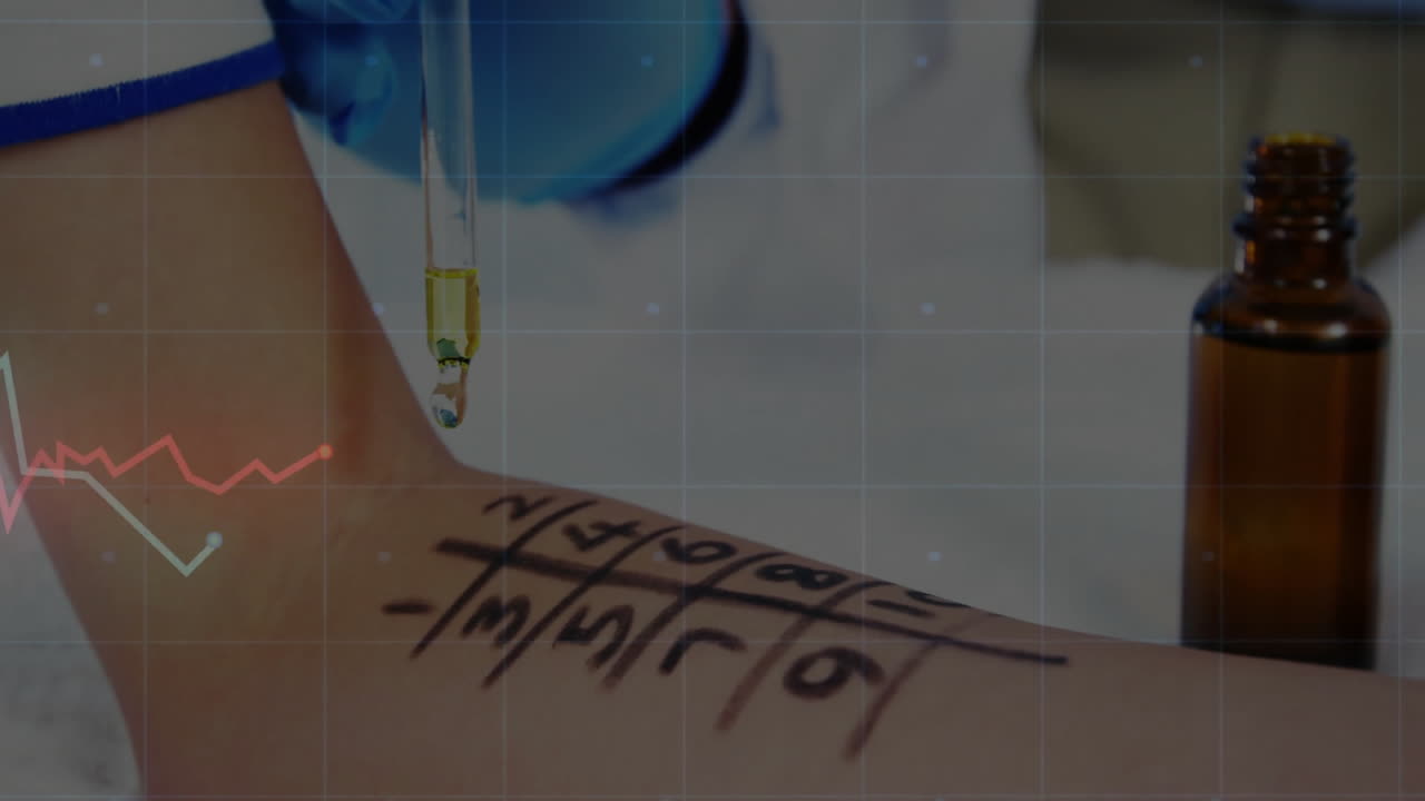 medical allergy skin test being animated in flat design, showing forearm grid and pipette drop