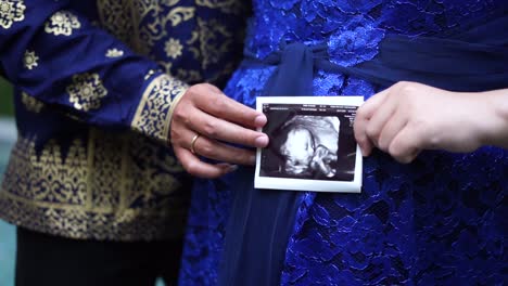 Couple-at-garden-holding-a-ultrasound-photo