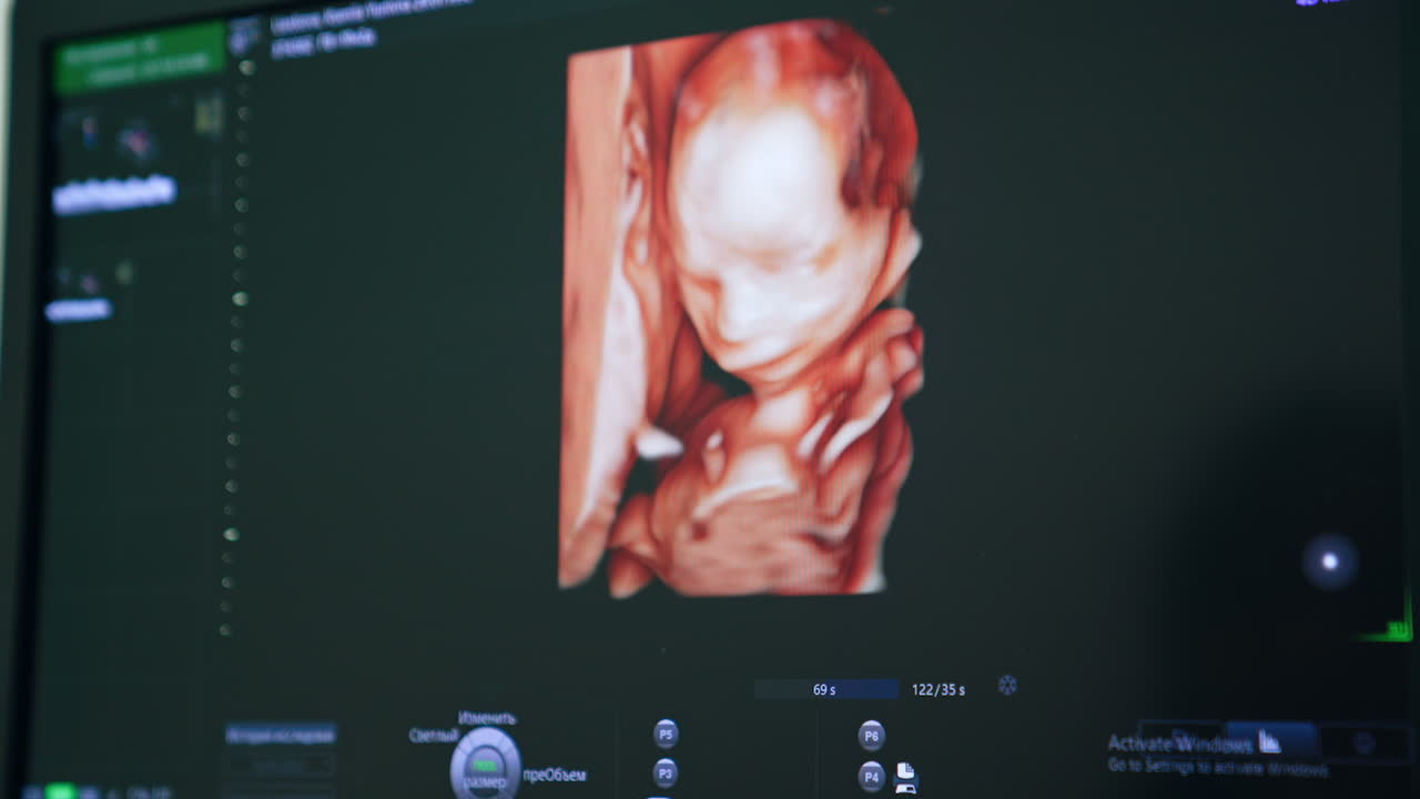 Ultrasonic image of a baby in mother's womb. Diagnostics of pregnancy at hospital. Close up.