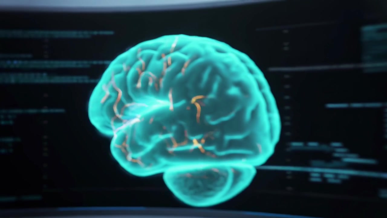 Visualização de Exame Cerebral Digital em Monitores de Laboratório Futurista