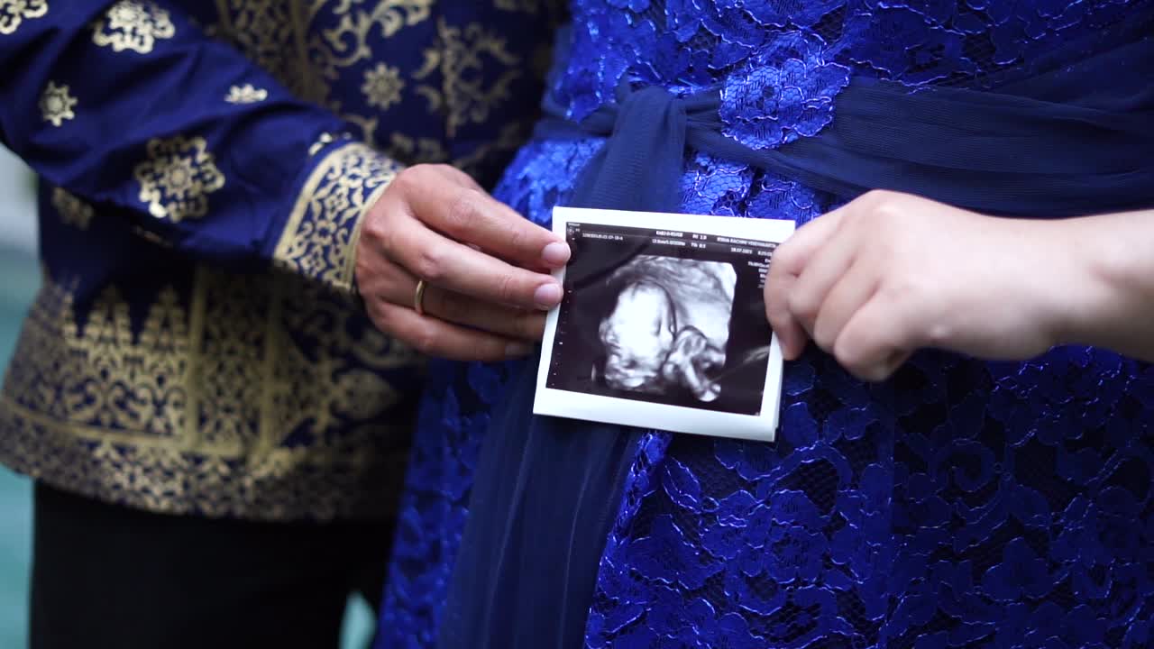 Couple at garden holding a ultrasound photo. Close up footage