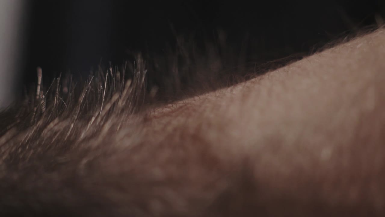 피부 머리 서 - 클로즈업 샷