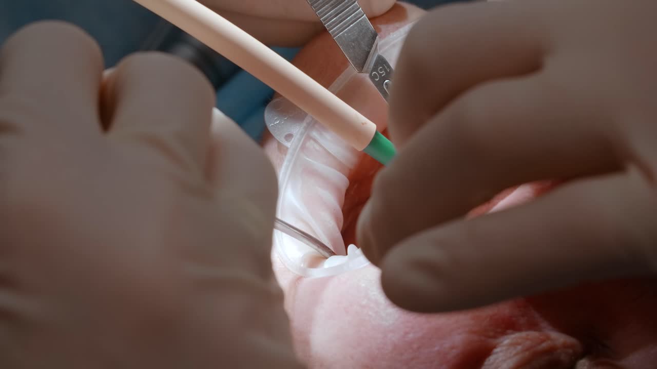 procedimiento dental