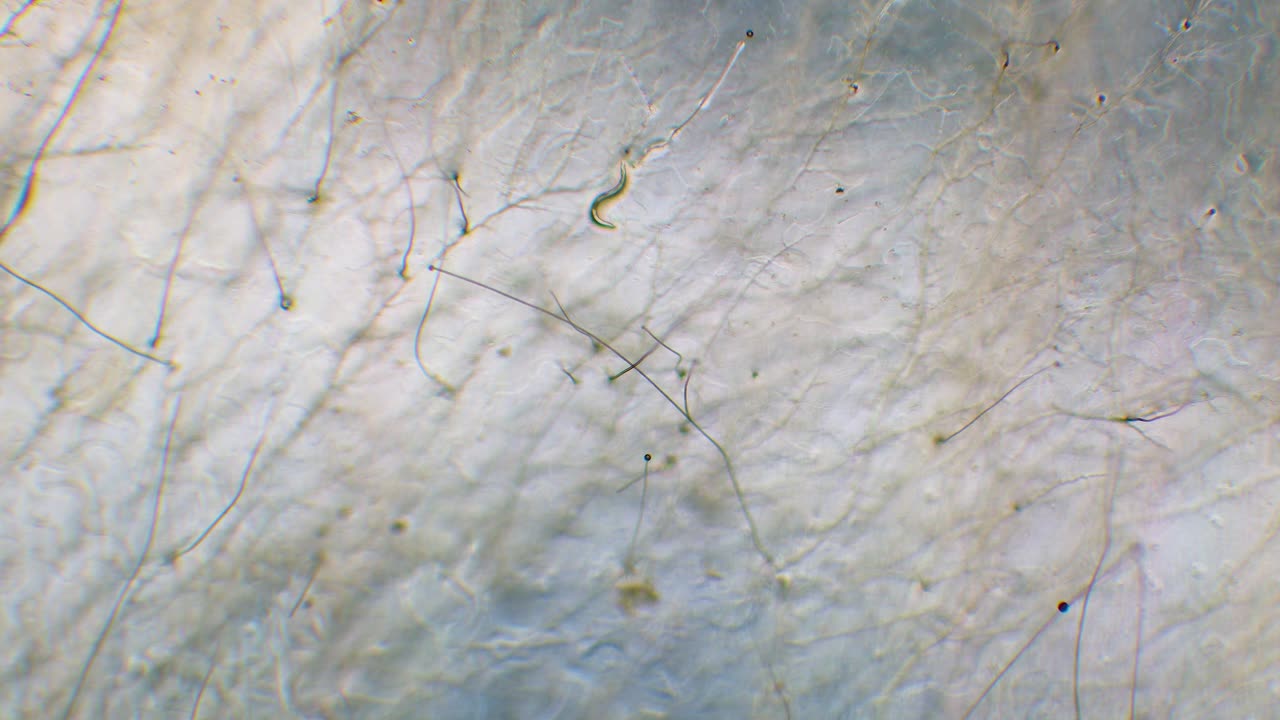 Single nemotode moving in Petri dish agar substrate