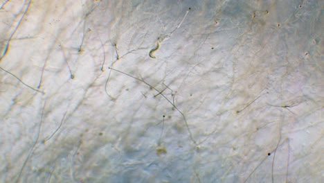 single nemotode moving in petri dish agar substrate