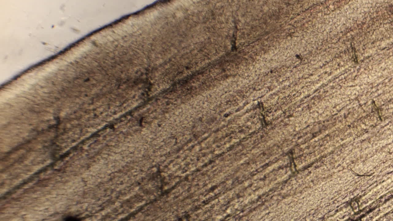 vista microscópica de los vasos sanguíneos en la piel