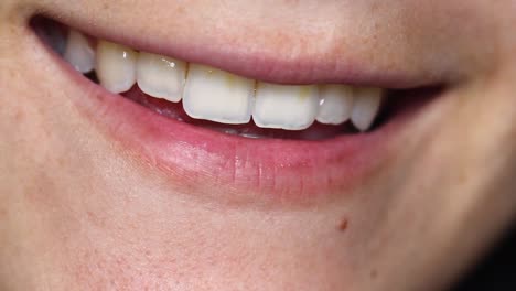 cicatrizarse, de, mujer sonriente, con, natural, sonrisa