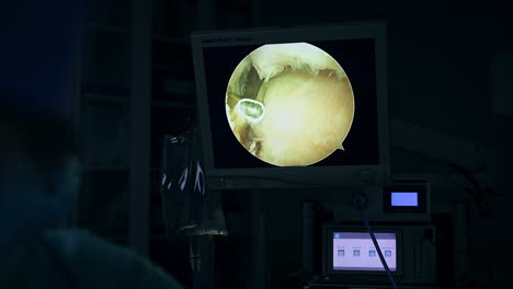 arthroscopic knee surgery