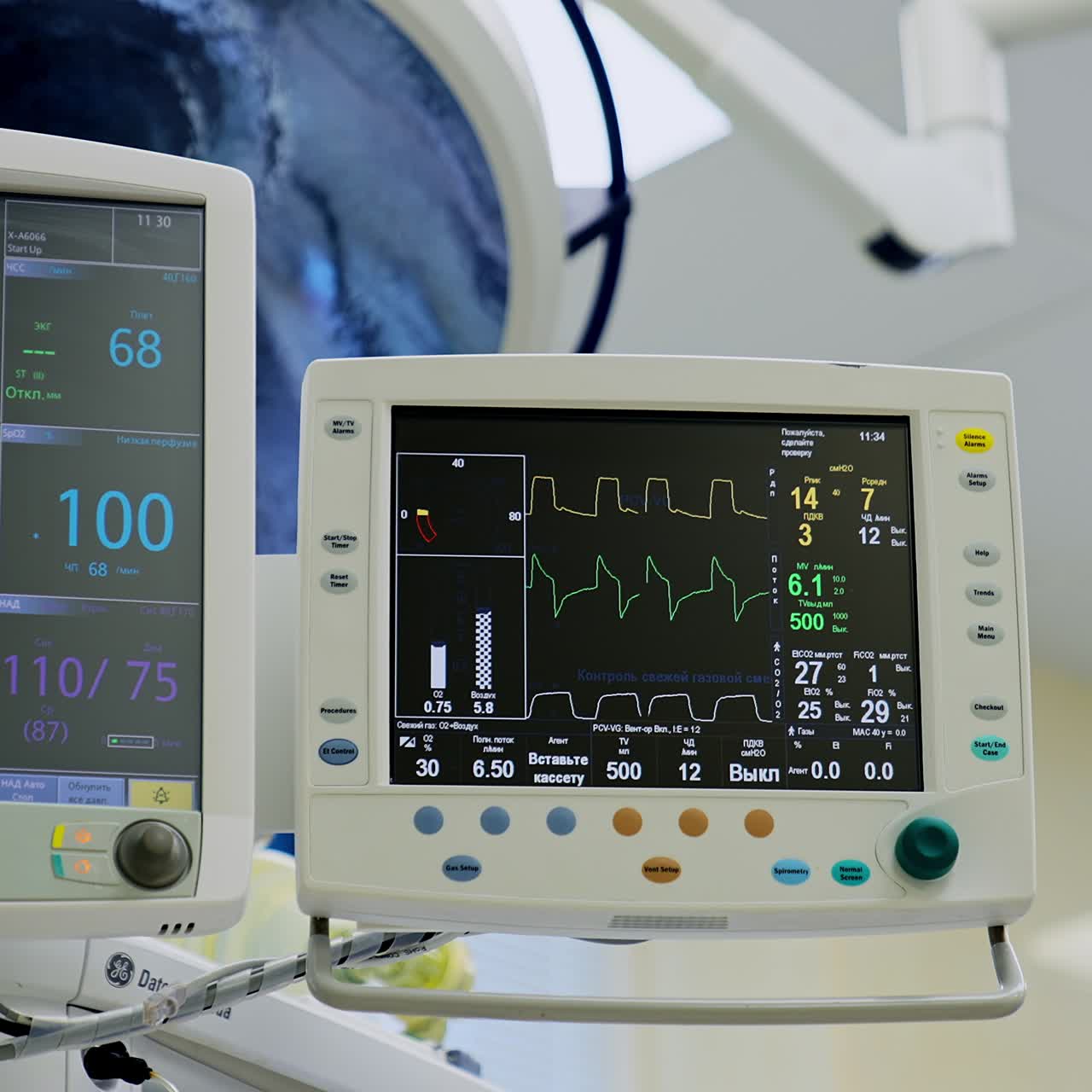 Bigger and smaller screens working during operation. Black monitors showing the lines and figures depicting life signs of an operated patient