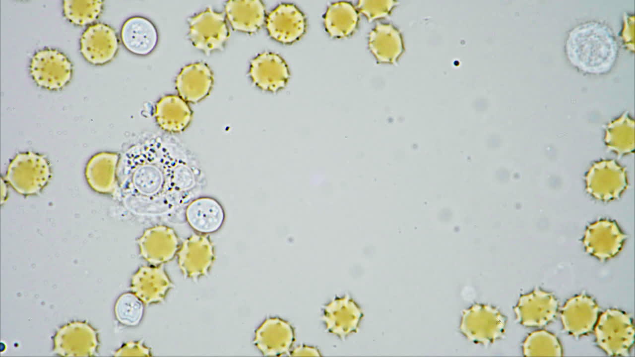 Microscopic view of round biological cells and pollen-like structures