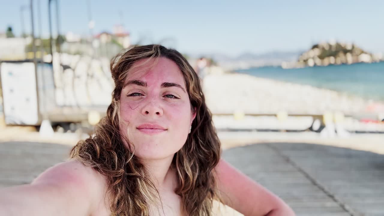 Sun Protection Fail: Tourist with Red Shoulders