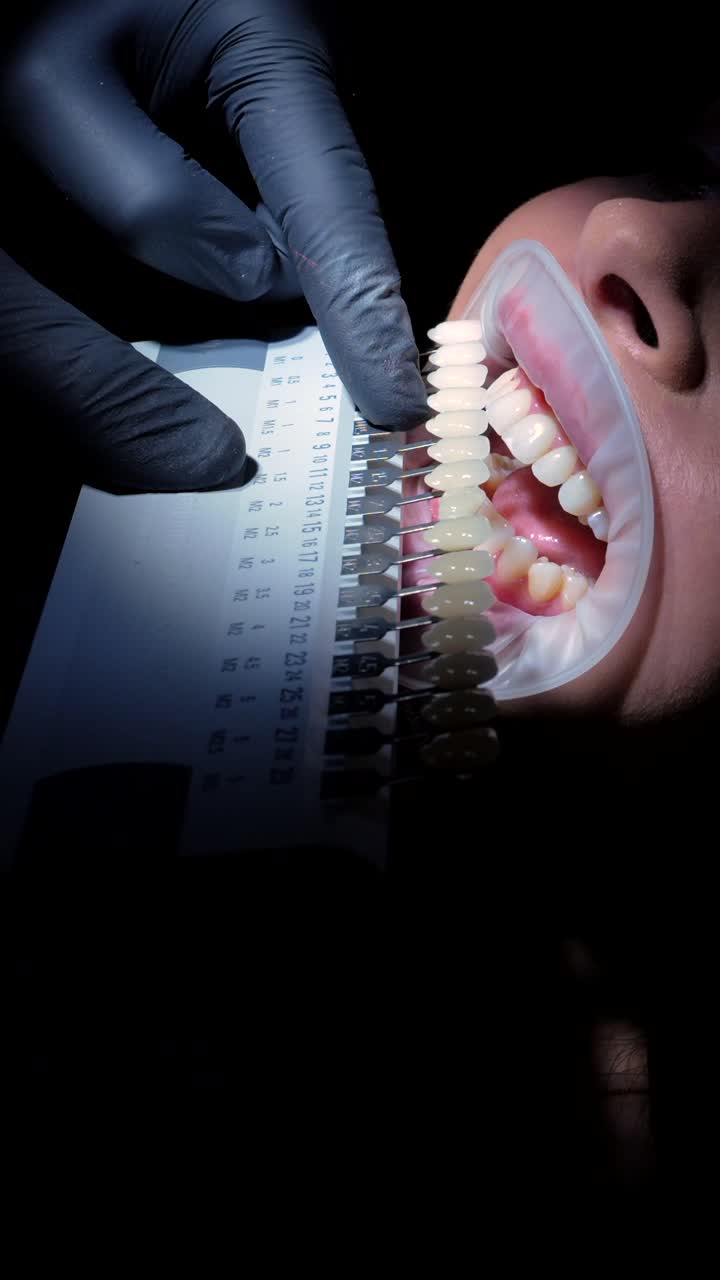 Teeth Whitening Procedure at the Dentist's Office