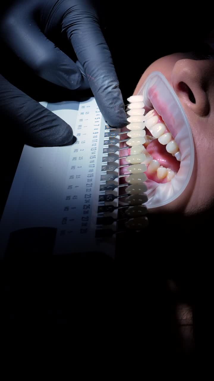 Teeth Whitening Procedure at the Dentist&#039;s Office