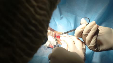 operación de cirugía plástica de blefaroplastia, centrada en el rejuvenecimiento y la modificación de la región del ojo.
